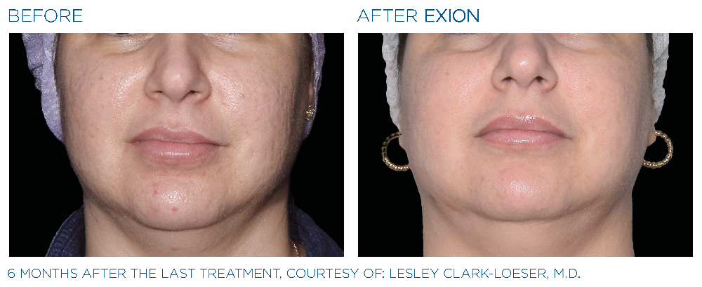 before and after facial aesthetics in Rutland