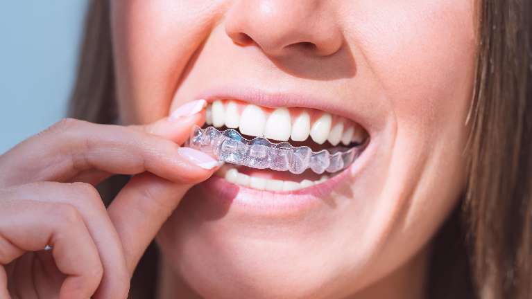 Invisalign Rutland | woman wearing clear aligners