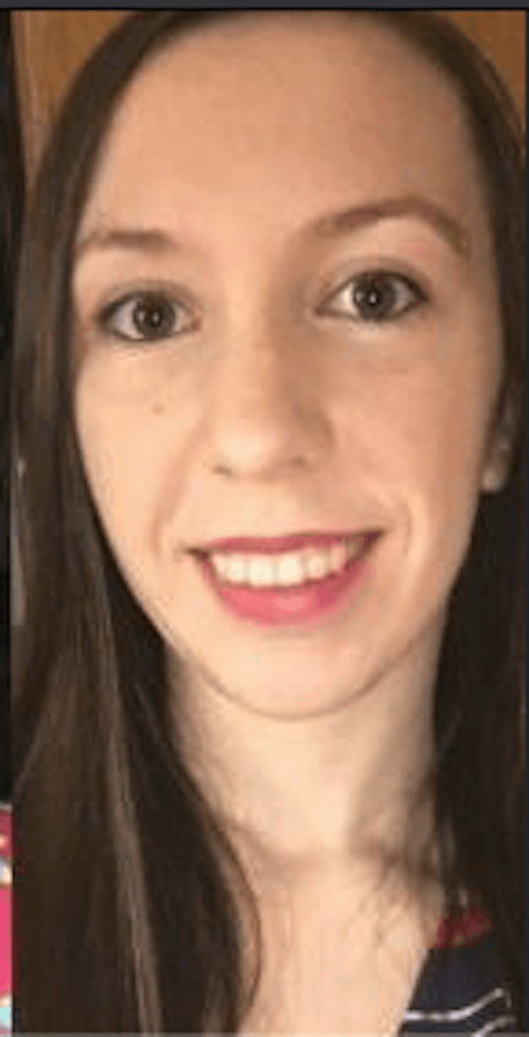 invisalign after treatment | dentist princeton