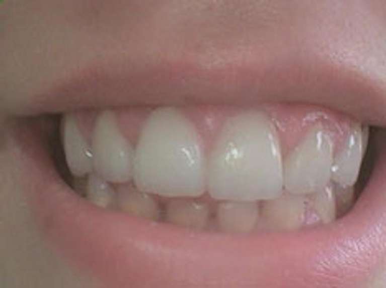 cosmetic dentistry after | dentist paxton