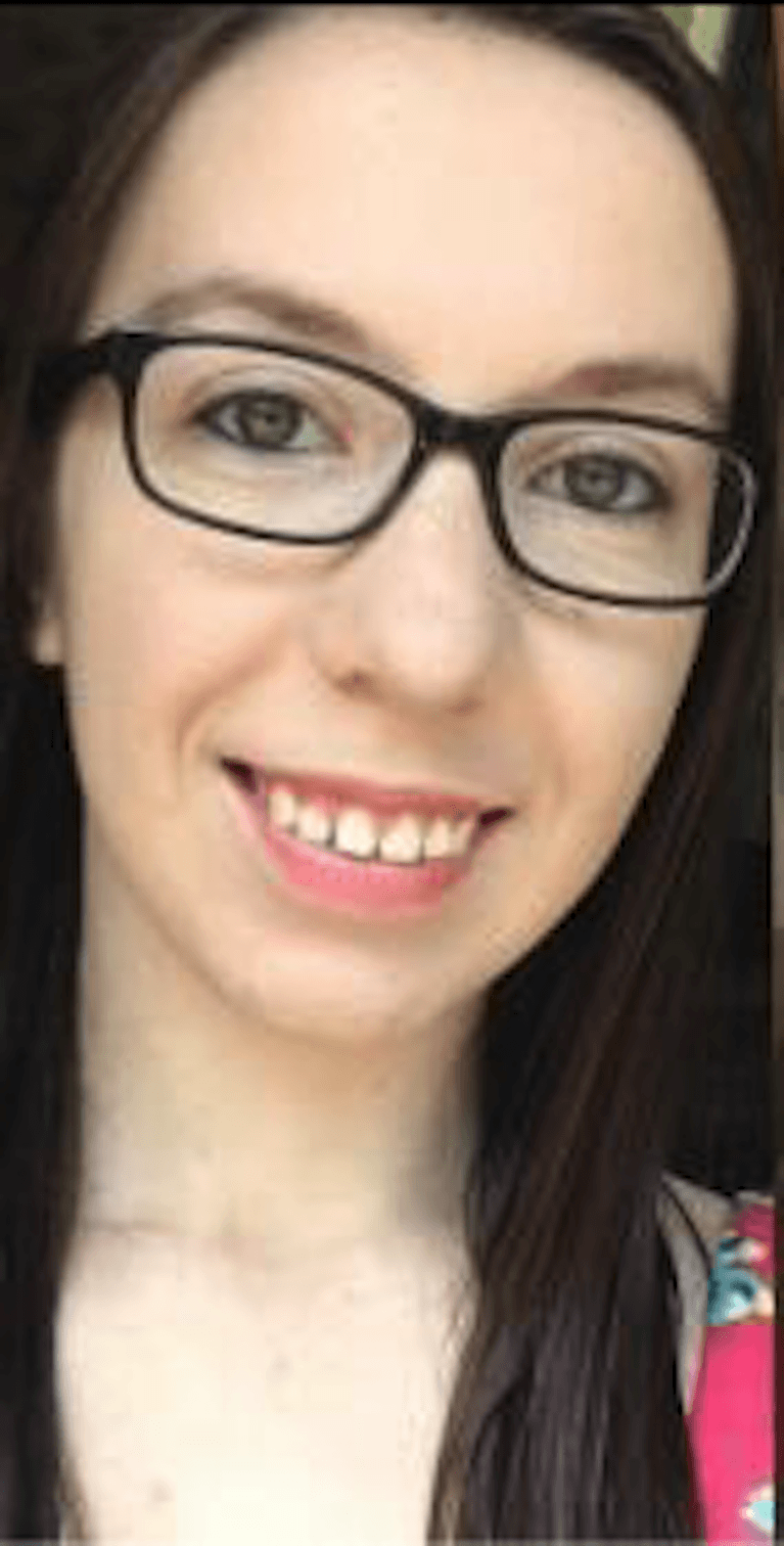 invisalign before treatment | dentist princeton