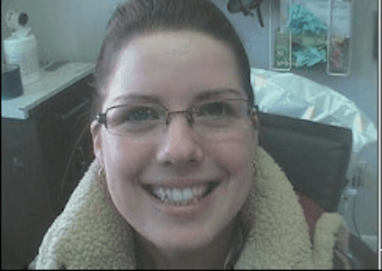 Invisalign before photo | dentist princeton