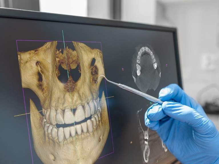 Dentist holden | CBCT technology