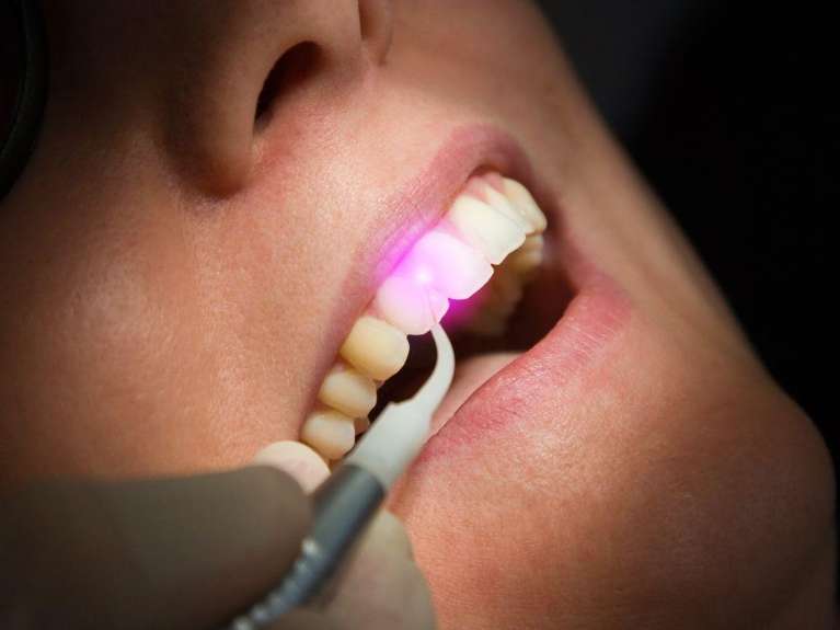 Dentist Princeton | laser dentistry