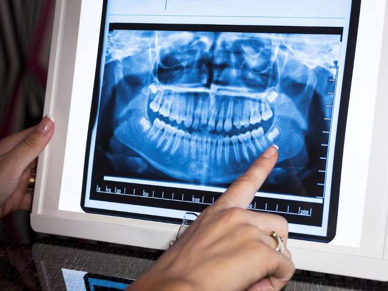 Dentist holden | panoramic x-ray